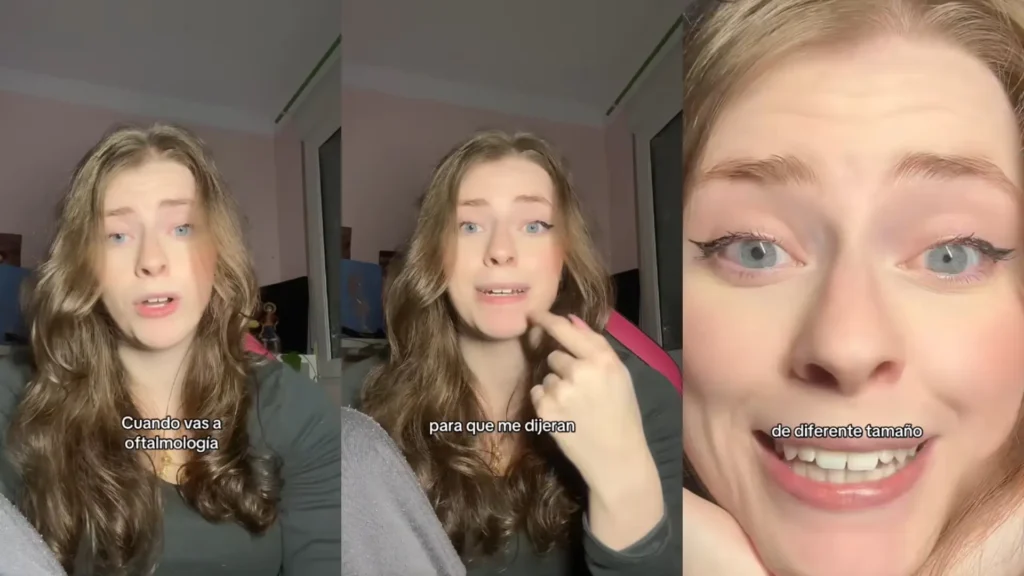 ¡Sorpresa en Urgencias! La Pupila Rebelde que Descolocó a TikTok