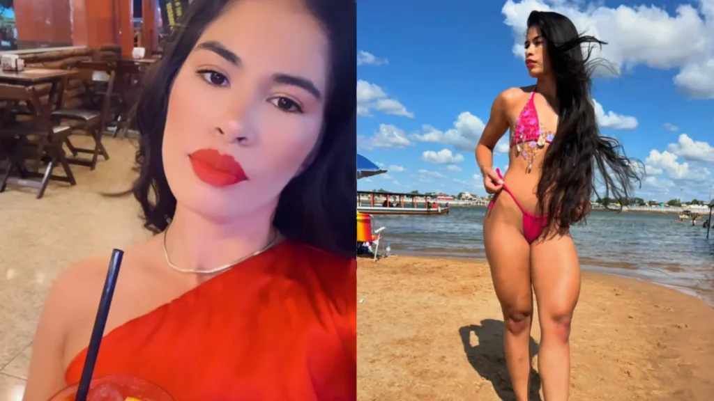 Tragedia en el Glamour: Adiós a Derleya Alves tras un Aumento de Pecho