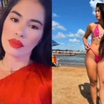Tragedia en el Glamour: Adiós a Derleya Alves tras un Aumento de Pecho
